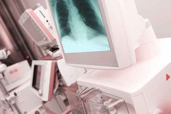 Röntgenbild des Brustkorbs auf dem Computerdisplay — Stockfoto