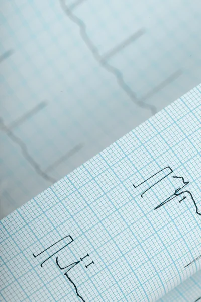 Ecg chart gefaltetes Papier Hintergrund — Stockfoto