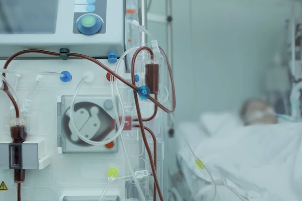 Аппарат гемодиализа подключен к пациенту в реанимации — стоковое фото