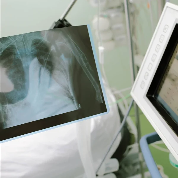 X-ray image in hospital ward — Stock Photo, Image