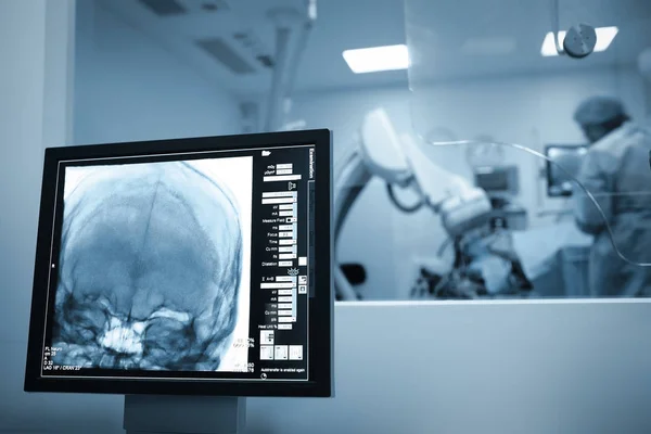 Exploración por rayos X del cerebro de los pacientes durante la cirugía — Foto de Stock