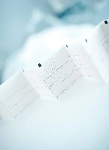 Papel plegado acordeón con registro ECG en la sala de pacientes — Foto de Stock