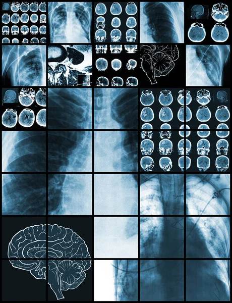 Set of medical test images, diagnostics concept — Stock Photo, Image