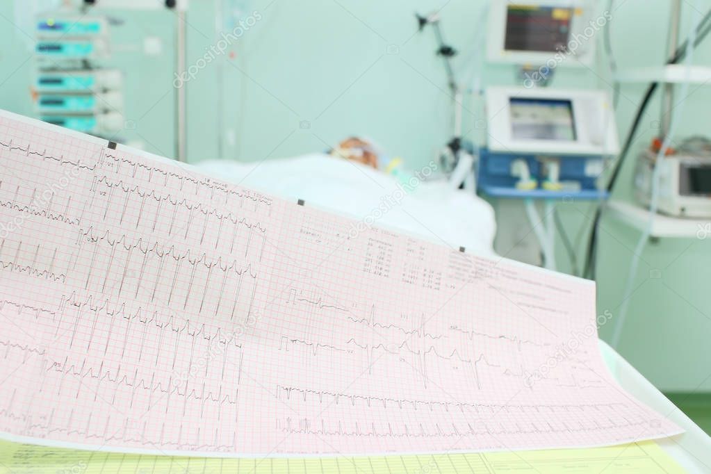 Test of heart activity in patient ward