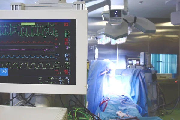 Processo de trabalho em sala de operações hospitalar com pessoas e — Fotografia de Stock