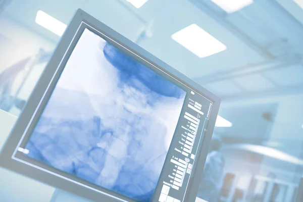 Computer monitoring in ziekenhuis catlab — Stockfoto