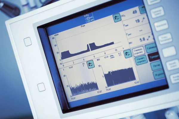 Technologies médicales en unité de soins intensifs — Photo