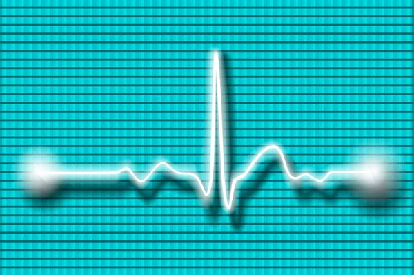 Onda cardiográfica sobre fondo borroso — Vector de stock