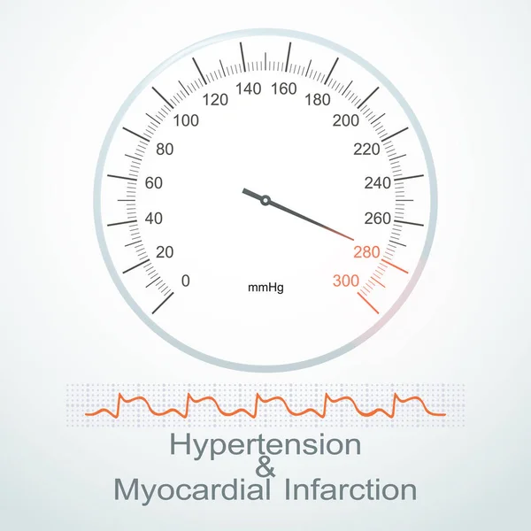 Hipertensão em indicadores de esfigmomanômetro (tonômetro) e m — Vetor de Stock