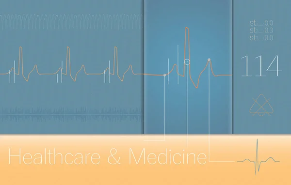 EKG-komplexek orvosi a monitor képernyő — Stock Vector