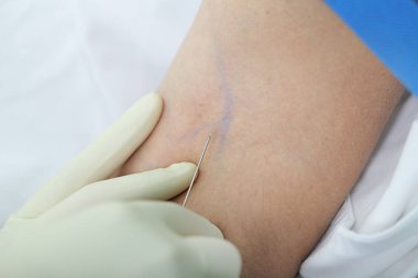 Hemşire inlect bir ilaç için hazırdır