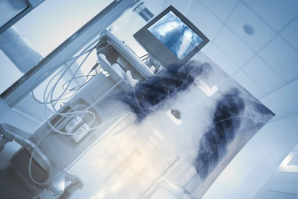 X 线胸部图像在医院与单位 — 图库照片