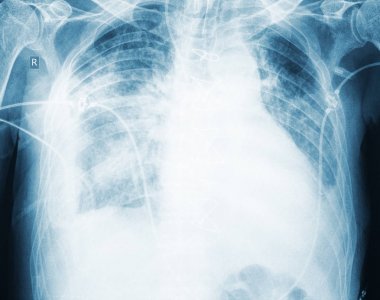 Sabırlı, tıbbi muayene kavramı görüntüsünü x-ışını