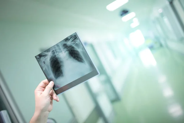 X-ray image of patient in man`s hand — Stock Photo, Image