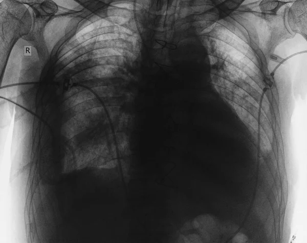 Image radiographique des organes thoraciques du patient — Photo