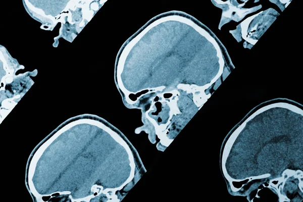 Resonancia magnética imagen de la cabeza como antecedentes médicos —  Fotos de Stock
