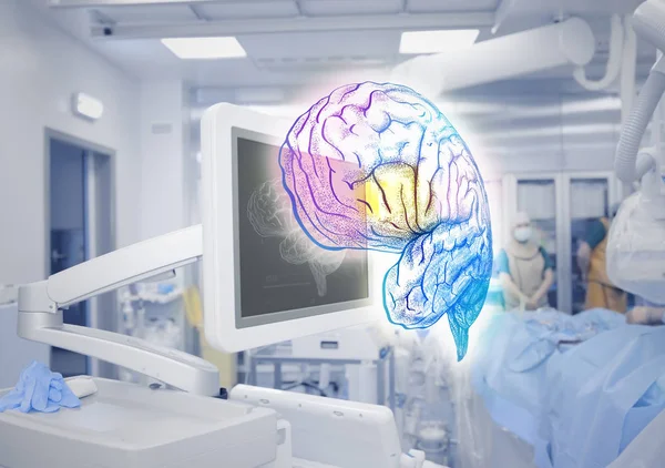 Tecnologias avançadas de exame cerebral em medicina — Fotografia de Stock