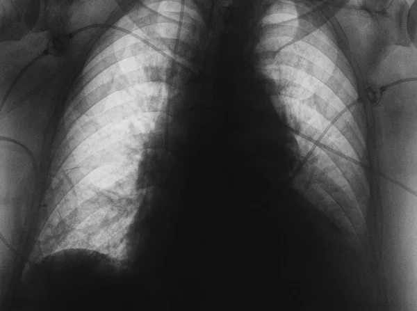 X-ray görüntüsü olarak ortak bir tıbbi geçmişi — Stok fotoğraf