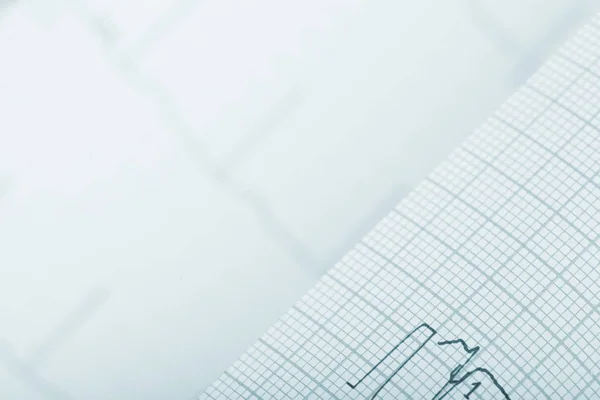 Background with a drawn out ECG chart — Stock Photo, Image