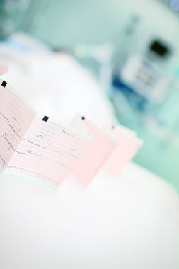 Hastane odası arka plan üzerine çöküp EKG kağıt