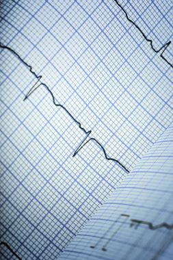 EKG kompleksleri çizgili kağıt üzerinde