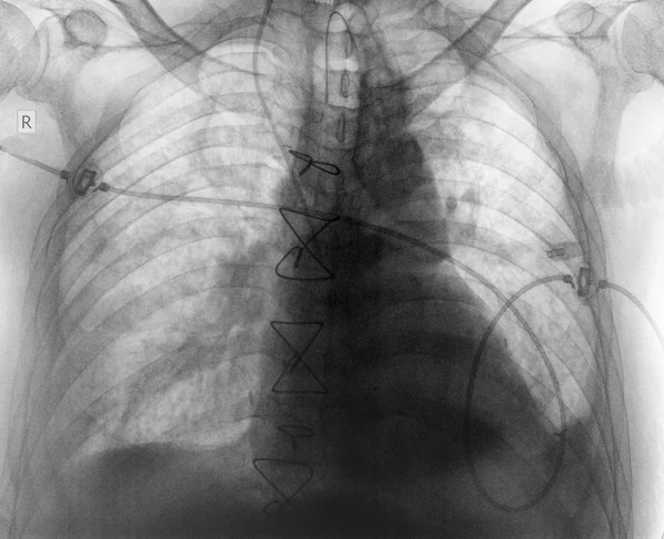 R-controle do paciente após a cirurgia — Fotografia de Stock