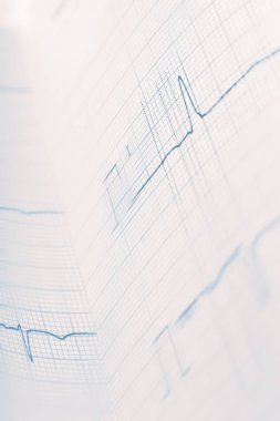 Elektrokardiyogram harekette