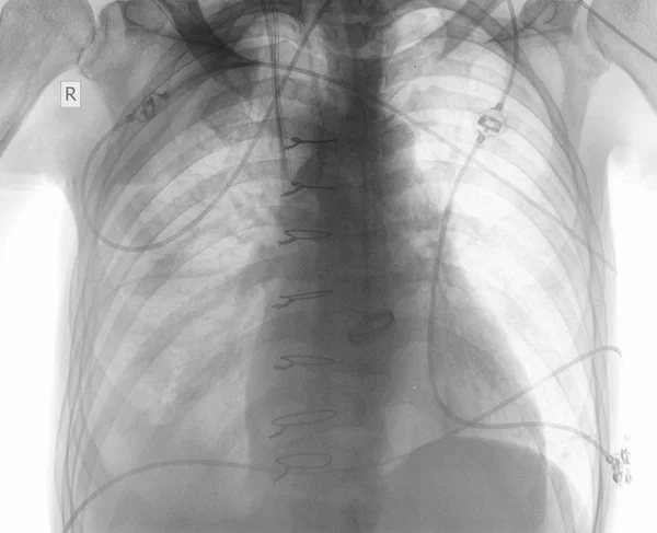 R-controllo del paziente dopo intervento chirurgico cardiaco — Foto Stock