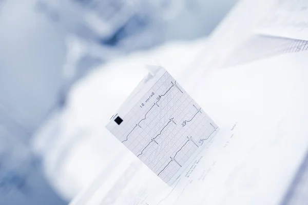 Карточка ЭКГ на размытом фоне больничного отделения — стоковое фото
