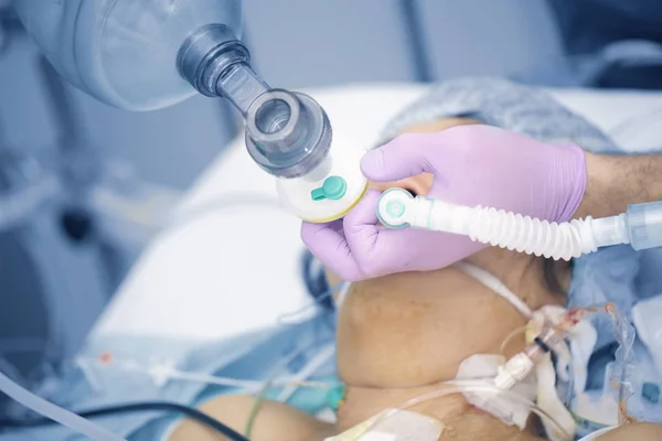 Manipulace s dýchací systém těžkou pacienta — Stock fotografie