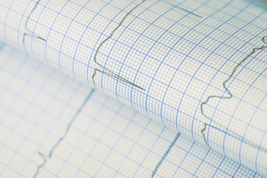 Tıbbi bir arka plan olarak bükülmüş EKG grafiği