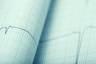 Hastanın EKG tıbbi kayıt