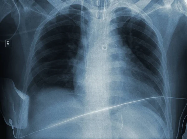 Результат рентгеновского обследования — стоковое фото