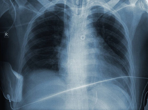 Result of an x-ray examination