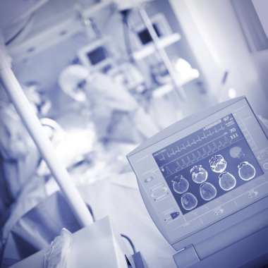 Ameliyathane durumda hastanın izlenmesi