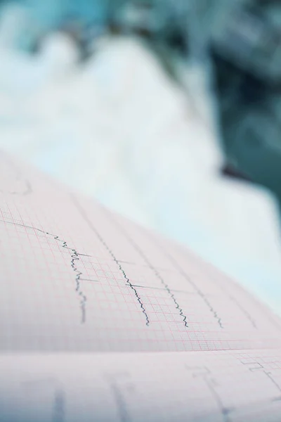 Wykres EKG na tle szpitalny — Zdjęcie stockowe