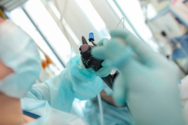 Endoskopik muayene iletken doktor