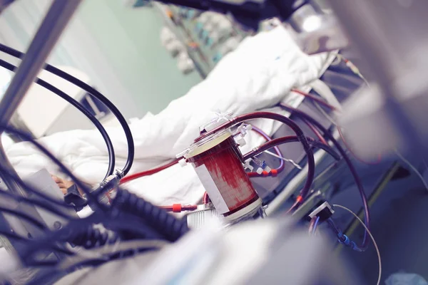 Серце – легенів машина працює в Icu — стокове фото
