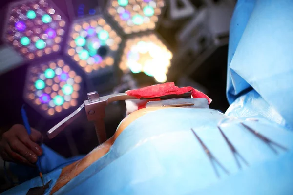 Paciente sometido a cirugía sobre la mesa — Foto de Stock