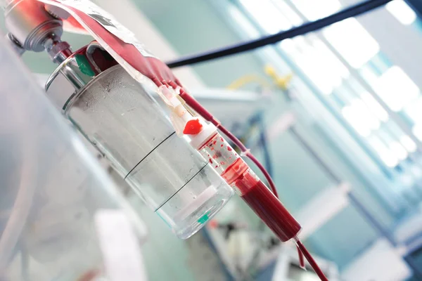 Treatment in the intensive care unit — Stock Photo, Image