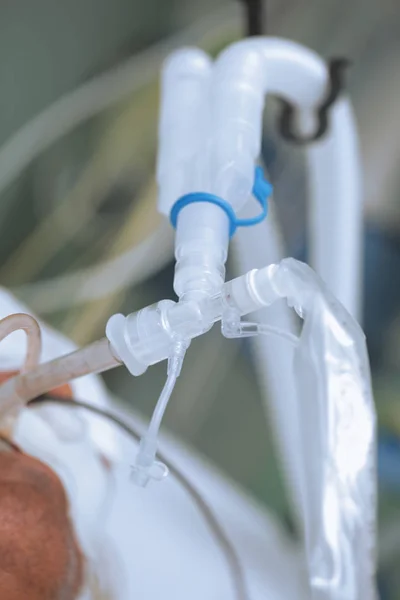 患者の肺換気装置 — ストック写真