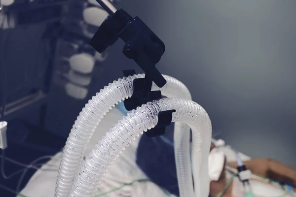 튜브를 호흡 하는 환자에 압축 된 증기 — 스톡 사진