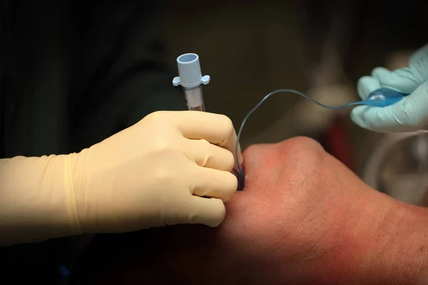 Intubation of the patient's trachea before surgery — Stock Photo, Image