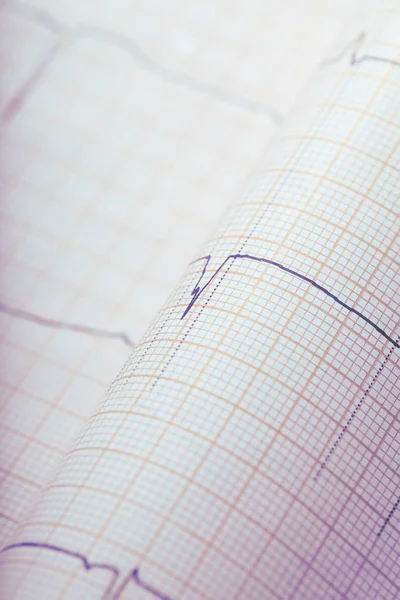 ECG record as a medical background — Stock Photo, Image