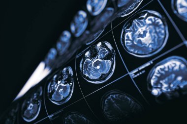 MRI beyin, insan aklının gizemleri kavramı