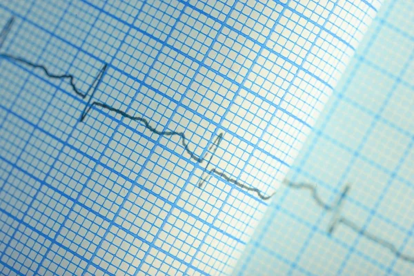 Eğri çizgi çizim kağıt