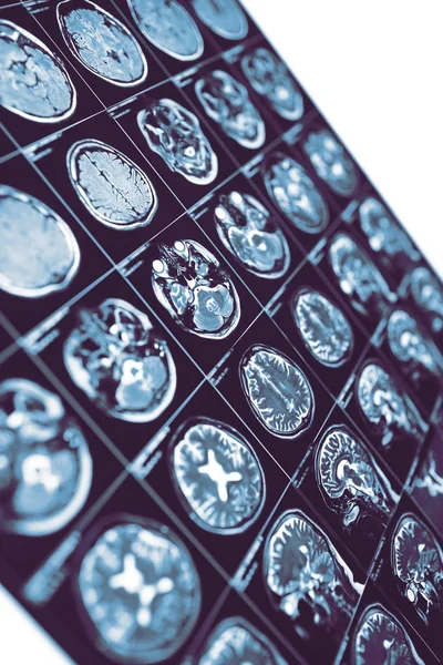 Сканированные участки головы человека, медицинское образование — стоковое фото