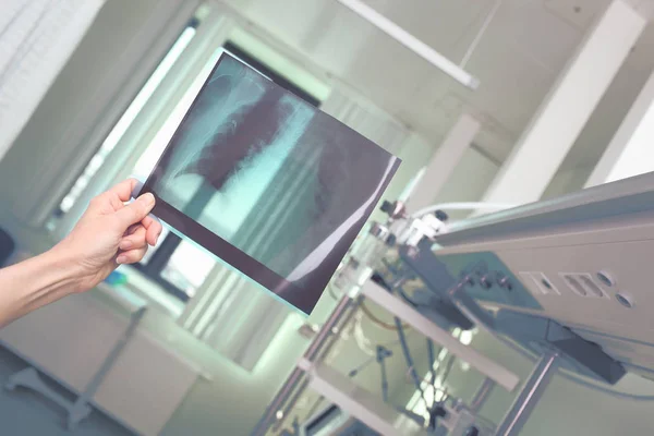 O médico examina o filme do R-controle do pulmão do paciente — Fotografia de Stock