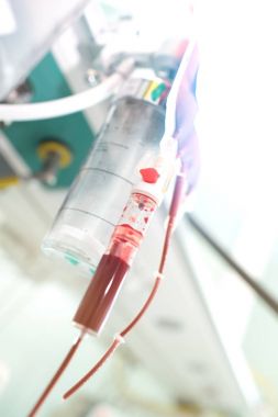 Hematherapy bakımda için tıp sistemi