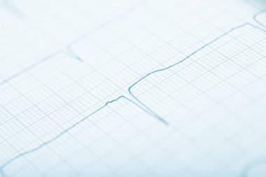 Eğri çizgi grafik kağıt üzerinde